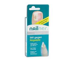 Nailner repair