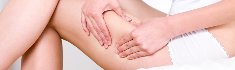 Cellulite